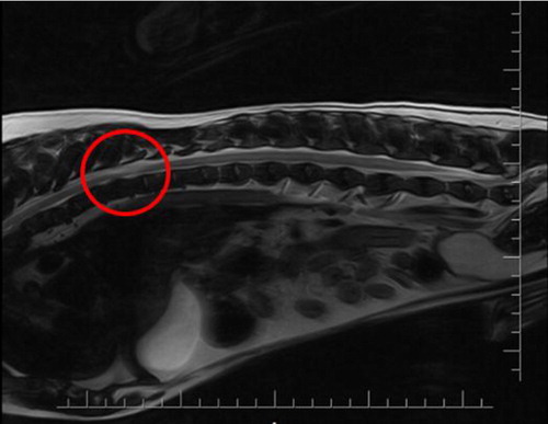 spinal