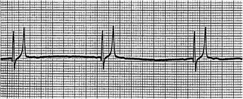 ECG interpretation - British Veterinary Nursing AssociationBritish ...