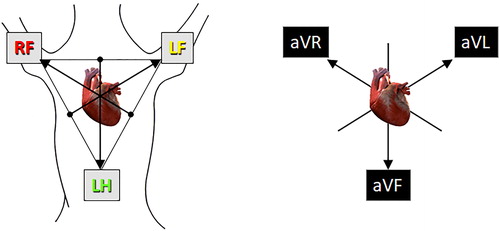 ECG