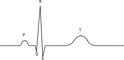 ECG