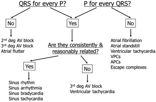 ECG