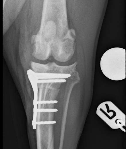 Tibial plateau levelling osteotomy surgery: A case study and nursing ...